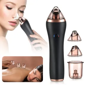4 in 1 Body Guasha Cupping Blackhead Remover Facial Pore
