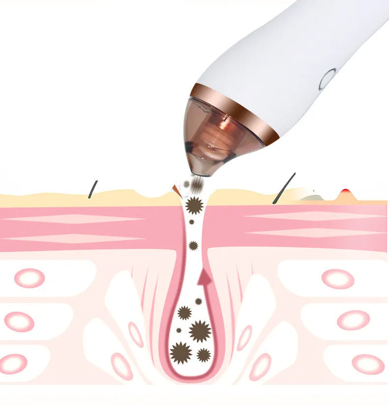 4 in 1 Body Guasha Cupping Blackhead Remover Facial Pore